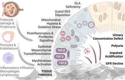 The role of tubular cells in the pathogenesis of Fabry nephropathy